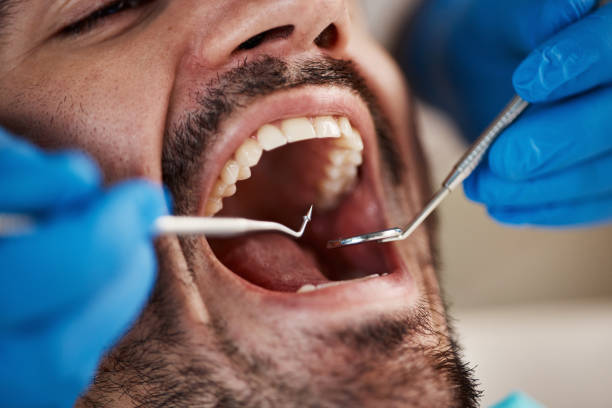 Best Emergency Care for Gum Disease in Rio Pinar, FL